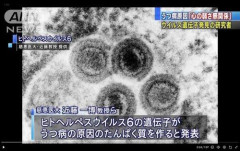 【朗報】うつ病を誘発するタンパク質を合成するヒトヘルペスウィルスさん、ついに発見されてしまうwwwwwwwwww