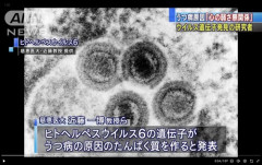 【朗報】うつ病を誘発するタンパク質を合成するヒトヘルペスウィルスが発見される